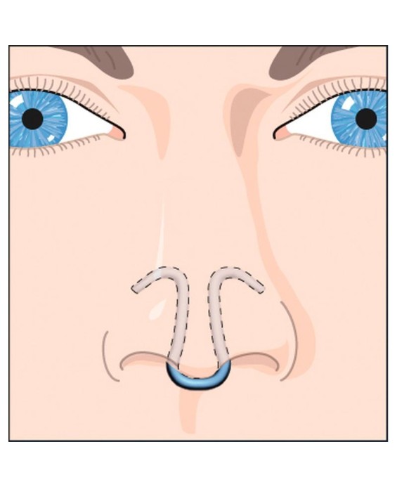 Dilatateur nasal Clip Air 856001 PROVIDOM 54